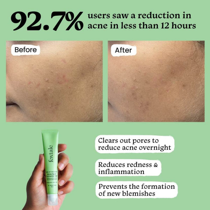 Foxtale Acne Spot Corrector Gel - 15 ml