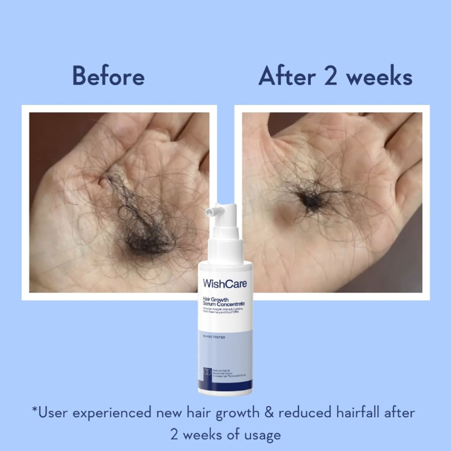 WishCare Hair Growth Serum Concentrate with Redensyl & Rosemary-In-Vivo Tested-Controls Hairfall