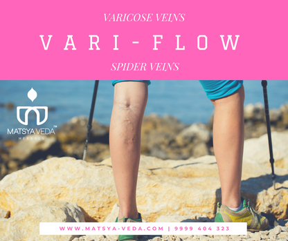 Matsyaveda Vari Flow: Varicose Veins