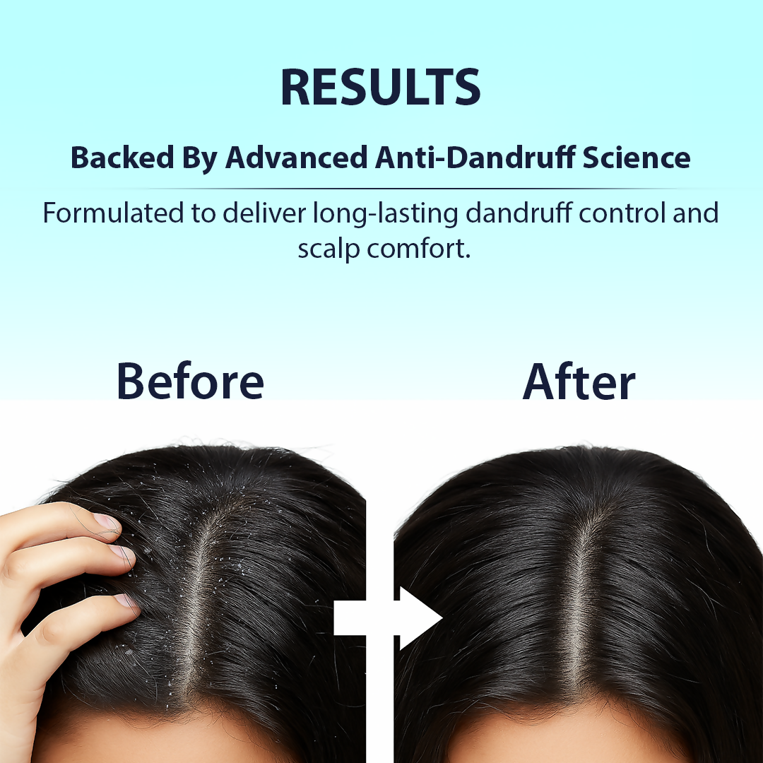 Dermistry Anti-Dandruff Control Hair Mask
