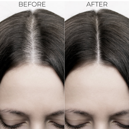 Brillare Ultimate Hair Fall Control kit