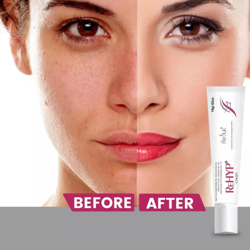 Revluk Rehyp Cream - 15 gms