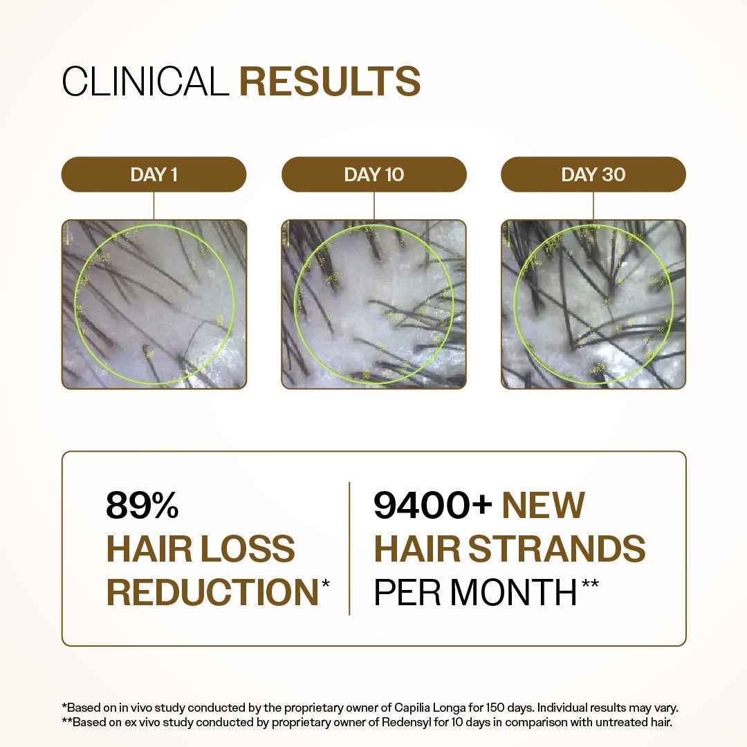 Bare Anatomy Advanced Hair Growth Serum - 30 ml