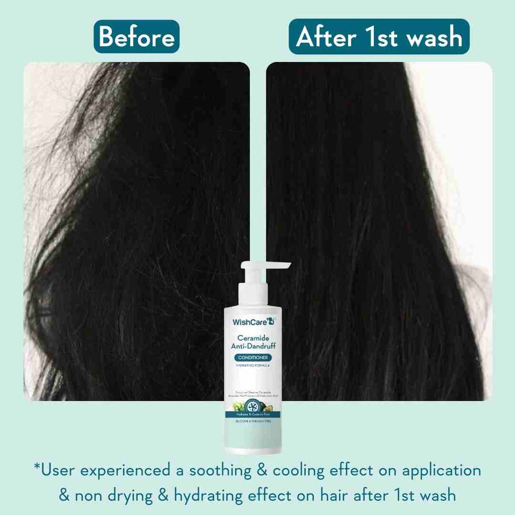 WishCare Ceramide Anti-Dandruff Conditioner - 200 ml