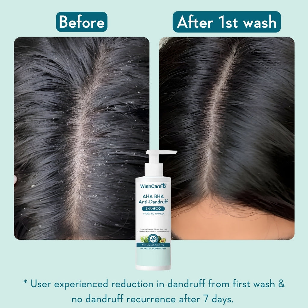 WishCare AHA BHA Anti-Dandruff Shampoo - 250 ml