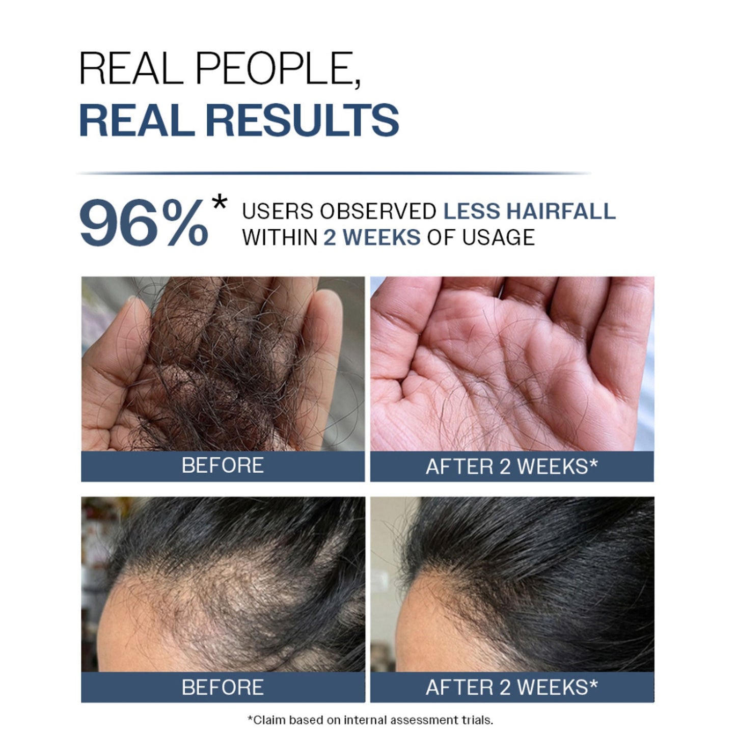 Bare Anatomy Anti-Hair Fall Shampoo 5X Hair Fall Control With Peptides