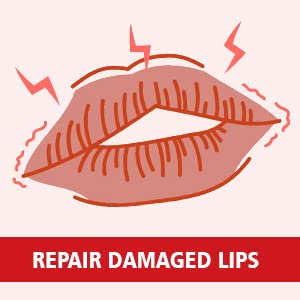 Sunny Lip Balm Provides Intense Moisture Keeping Lips Smooth & Protected - 10 gms (Pack of 4)