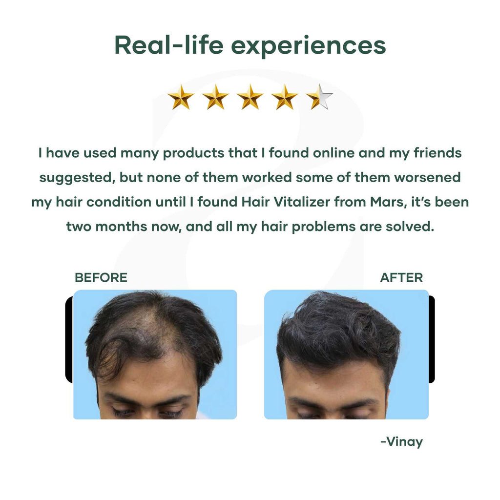 Mars by GHC Hair Vitalizer with 3% Redensyl - 60 ml