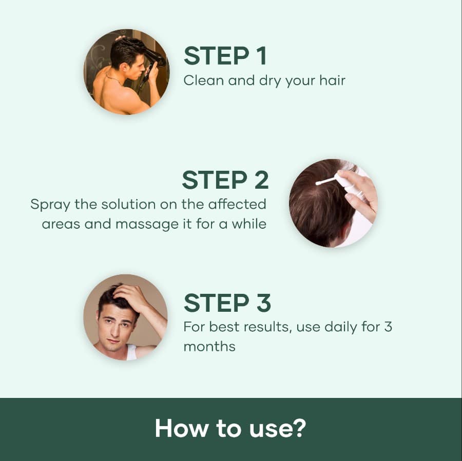 Mars by GHC Minoxi 5% Topical Solution for Hair Regrowth  Best Hair Loss Treatment - 60 ml