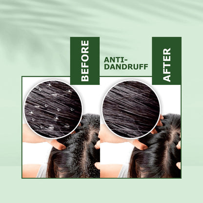 Nuerma Science Anti-Dandruff Hair Oil | Dandruff Relief & Scalp Rejuvenation