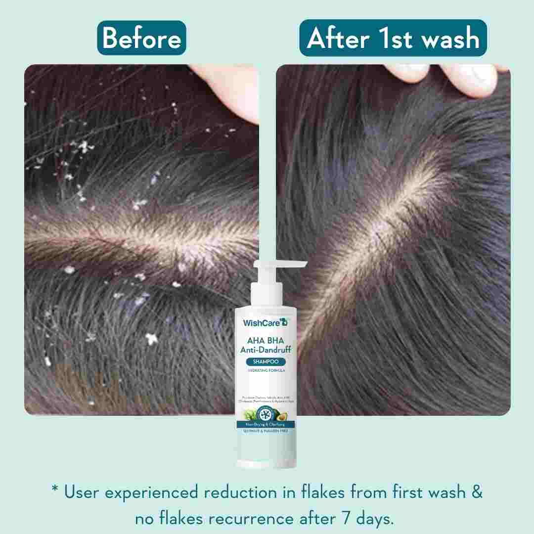 WishCare AHA BHA Anti-Dandruff Shampoo - 250 ml