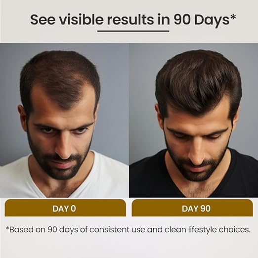 Lio Cosmeds Biofolli-S Anti Hair Fall Shampoo for Hair Growth - 100 ml