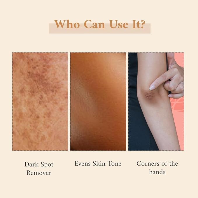Zanya Depigmentation Body Cream - 50 Gms
