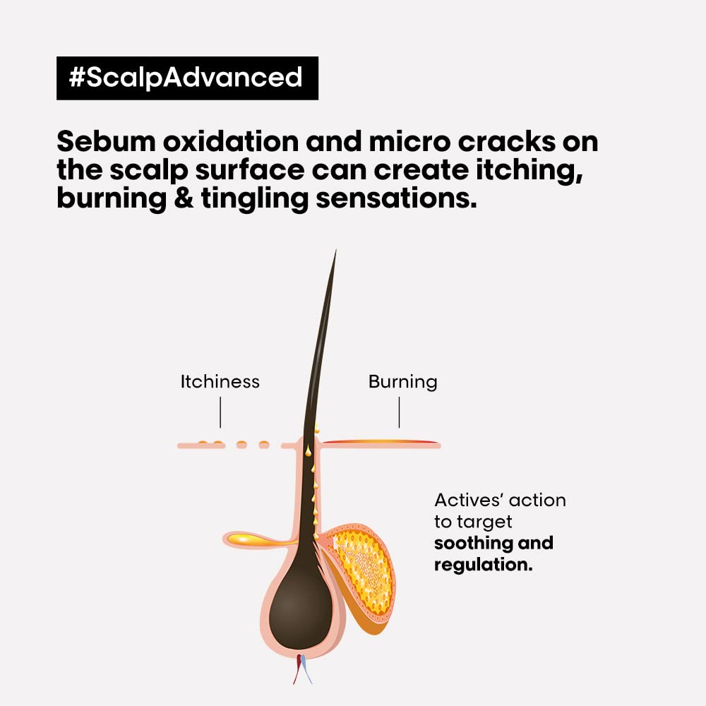 L’Oréal Professionnel Scalp Advanced Anti-Discomfort Dermo-Regulator Shampoo - 300 ML