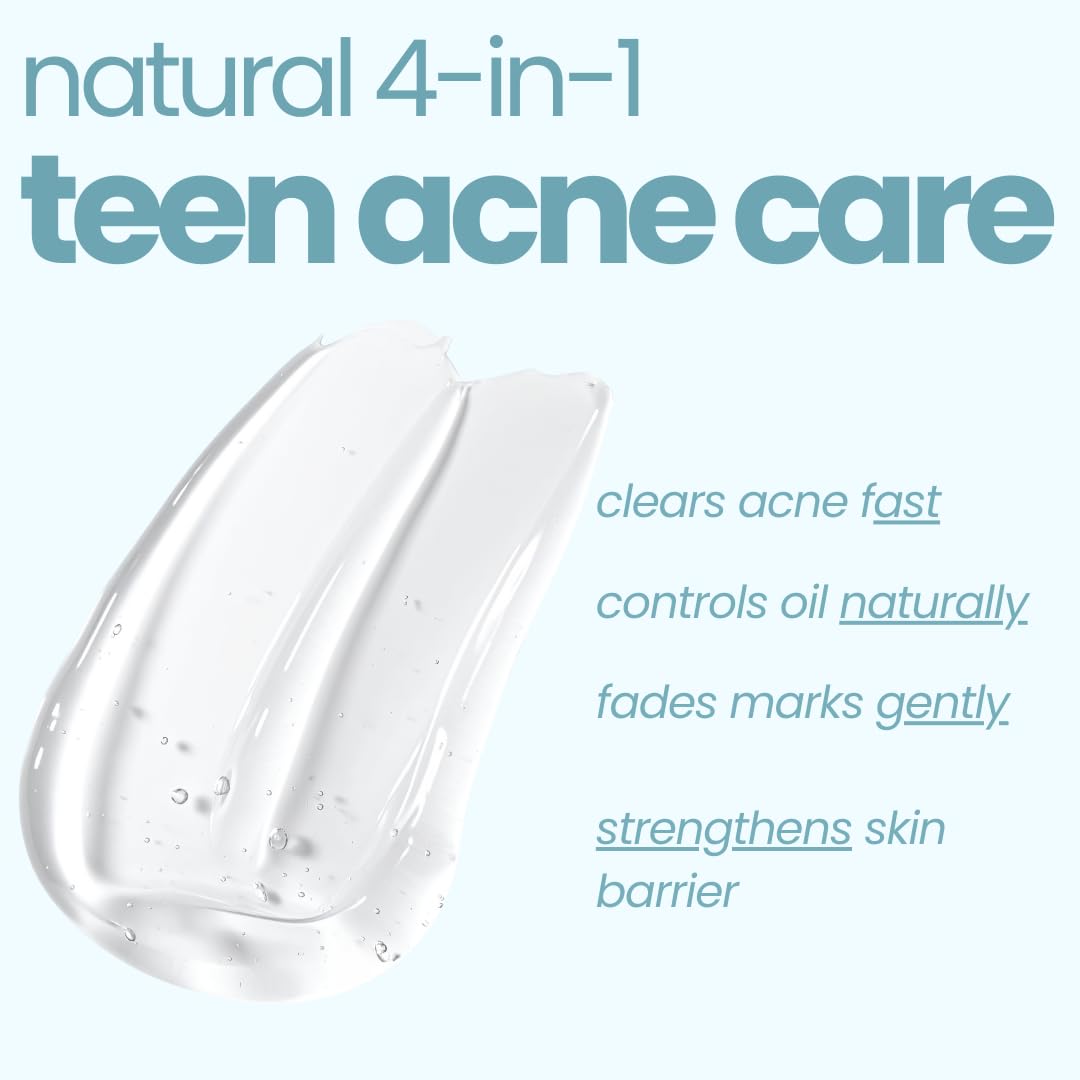 TucoÂ® Anti-Acne Teens Gel Face Cream & Moisturizer | Enriched with Aloe Vera, Tea Tree Oil & Rose Mary | Safe, Hydrates & Soothes Irritated Skin | Used for Dryness & Irritation, Cuts, Sunburn & Bruises | 50 gm