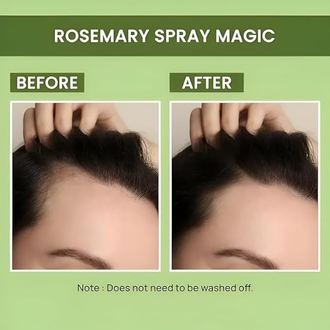 Alps Organic Rosemary Water Spray - 100 ml (Pack of 2)