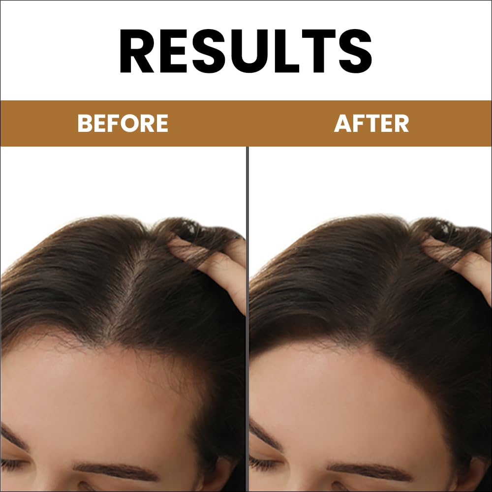 Myupchar Ayurveda KeshArt Bhringraj Hair Cleanser (Shampoo) - 200 ml