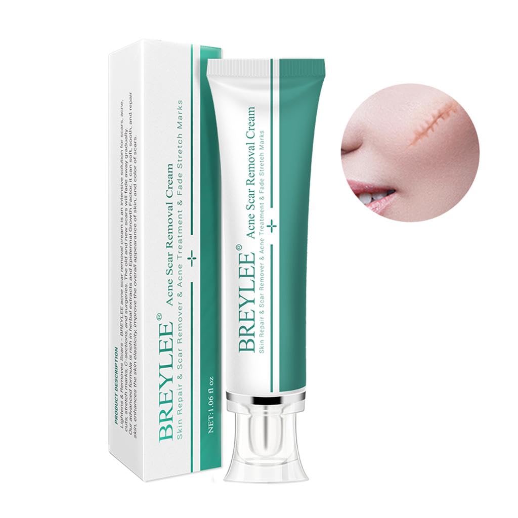 CLUB BOLLYWOODÂ® Removal Scar Cream Face Pimples Scar Stretch Marks Removal Acne Treatment | Bath & Body | Scar & Stretch Mark Reducers