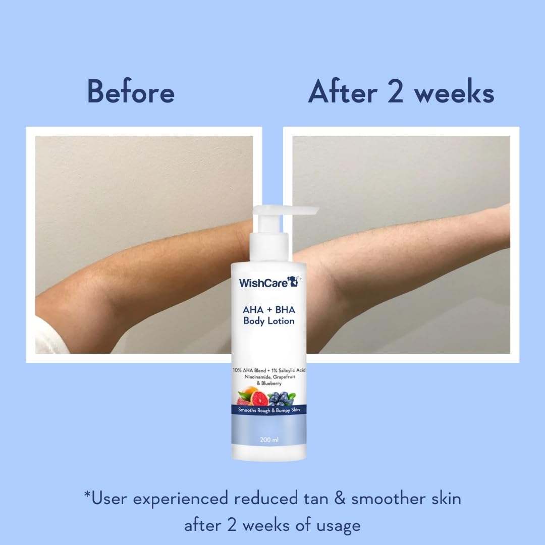 WishCare AHA BHA Body Lotion For Dry Skin | Provides Deep Hydration, Detans & Smooths Rough Skin | With 10% AHA & 1% BHA | Body Lotion For Men & Women | 200ml