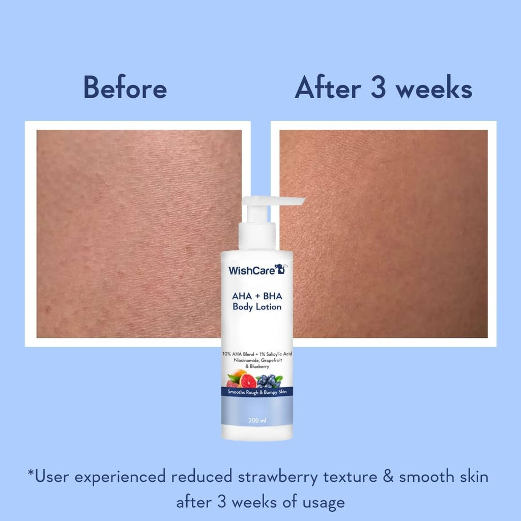 WishCare AHA BHA Body Lotion For Dry Skin | Provides Deep Hydration, Detans & Smooths Rough Skin | With 10% AHA & 1% BHA | Body Lotion For Men & Women | 200ml