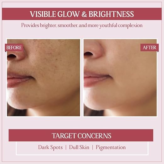 Trust Your Choice Ayurveda Glycobright Day SPF-30 Face Cream - 50 gms