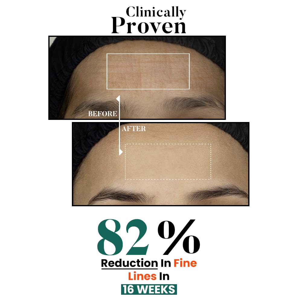 Bio Code 0.1% Exosome & 0.4% PDRN Moisturizer (100ml) â€“ For Anti-Ageing & Skin Regeneration | With 1.5% Peptide Complex, 1% Ceramide Complex & 0.5% Squalane | AI-Enhanced Formula | Dermatologist Recommended