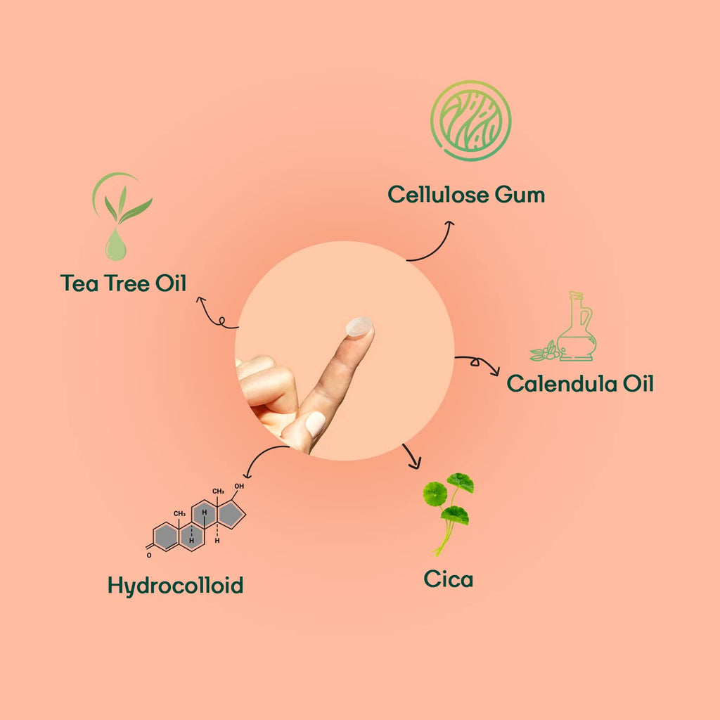 MOUNTAINORÂ® Acne Pimple Patch For Men - Hydrocolloid + Tea Tree Oil Potent Spot Cover, Fast Breakout Healing, Overnight Removal Of Acne Gunk, Waterproof Invisible Patches, Safe & Certified 72 Patches.