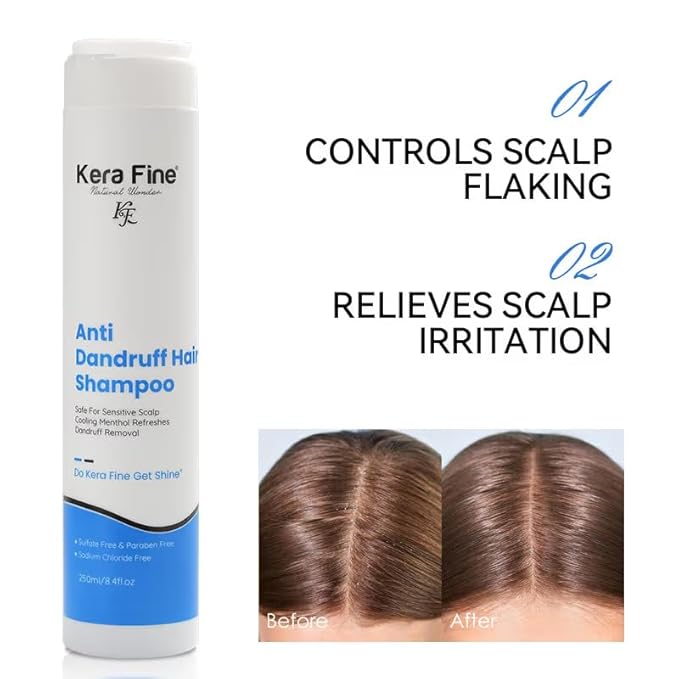 Kera Fine Anti Dandruff Shampoo - 250 ml