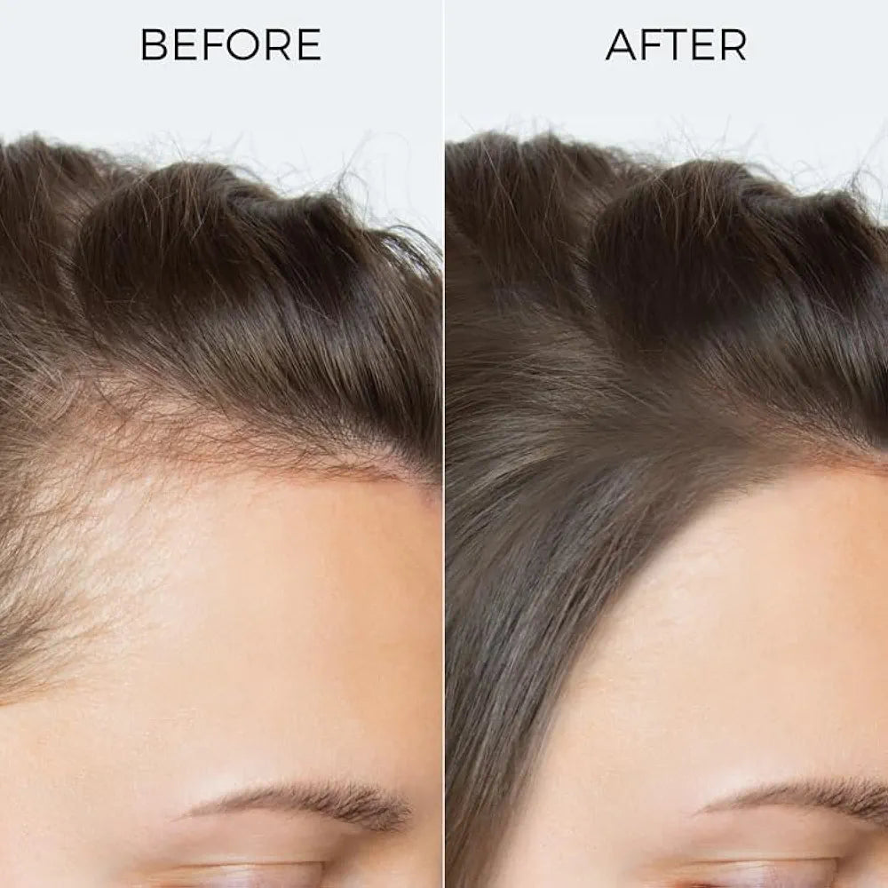 Brillare Pure Rosemary Essential Oil for Hair Growth & Scalp Nourishment - 15 ml