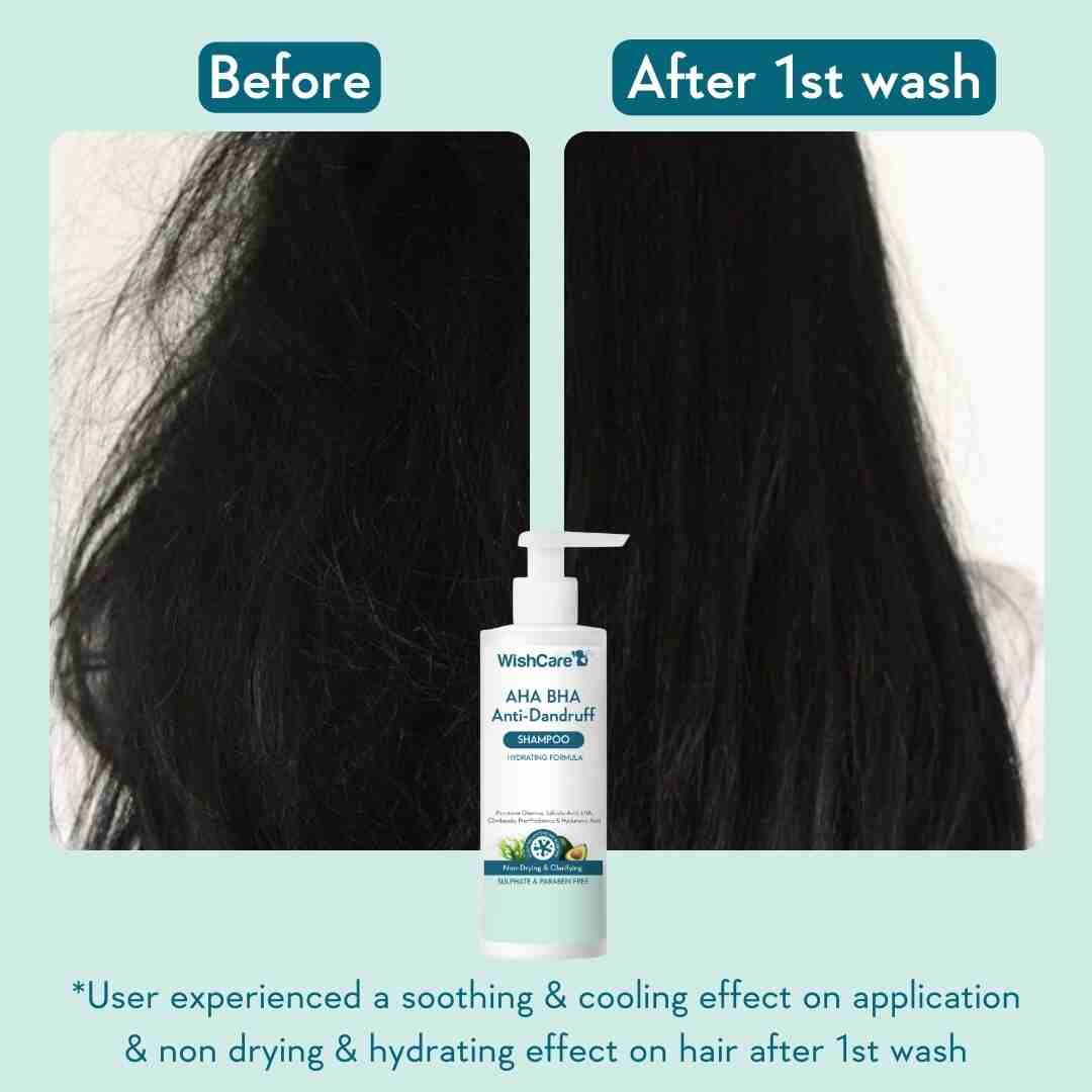 WishCare AHA BHA Anti-Dandruff Shampoo - 250 ml