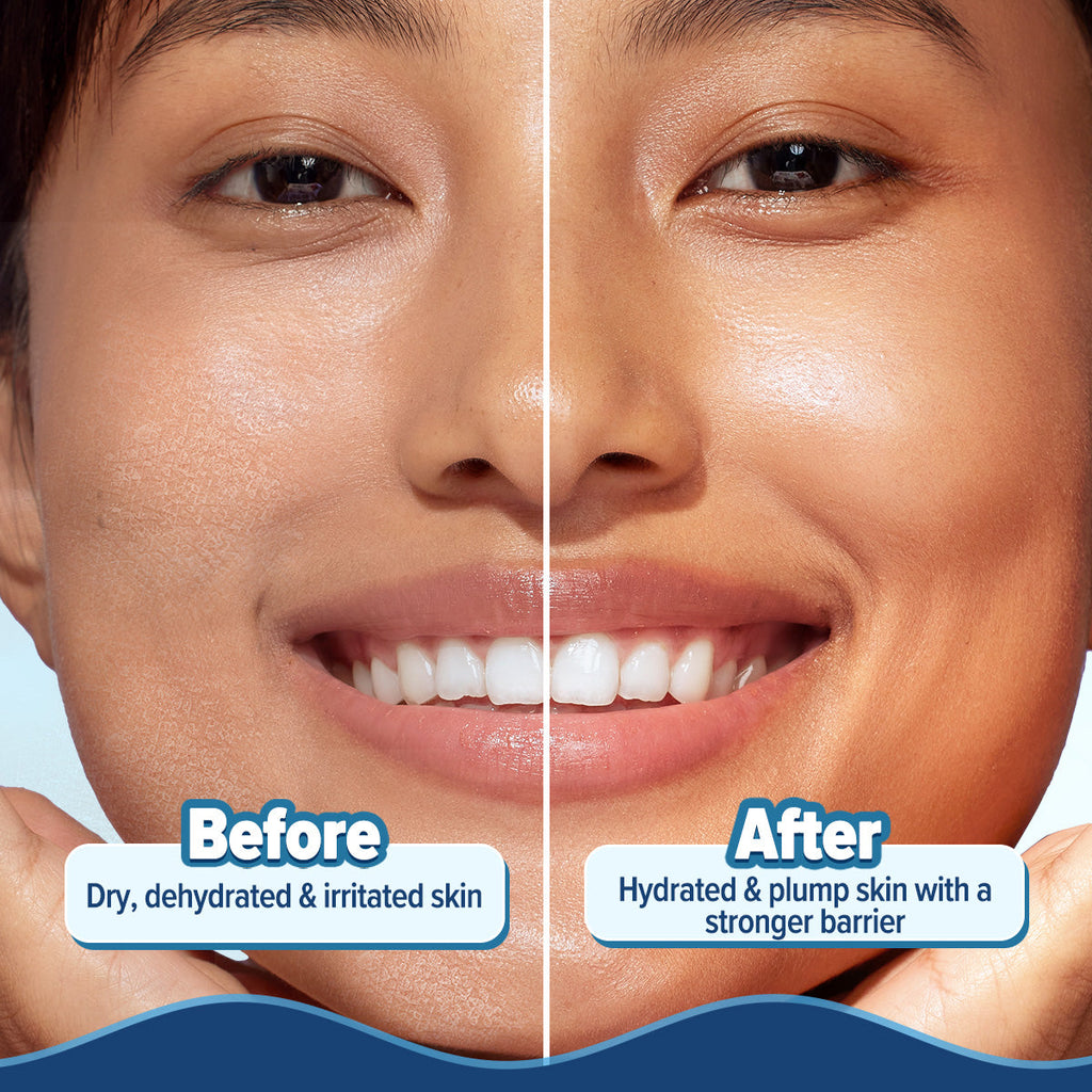 Aqualogica 5 Barrier+ Hydra Gel Moisturizer - 200 gms