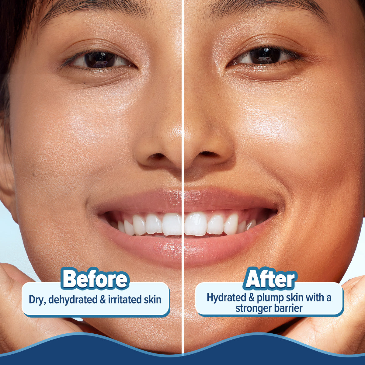 Aqualogica 5 Barrier+ Hydra Gel Moisturizer - 200 gms