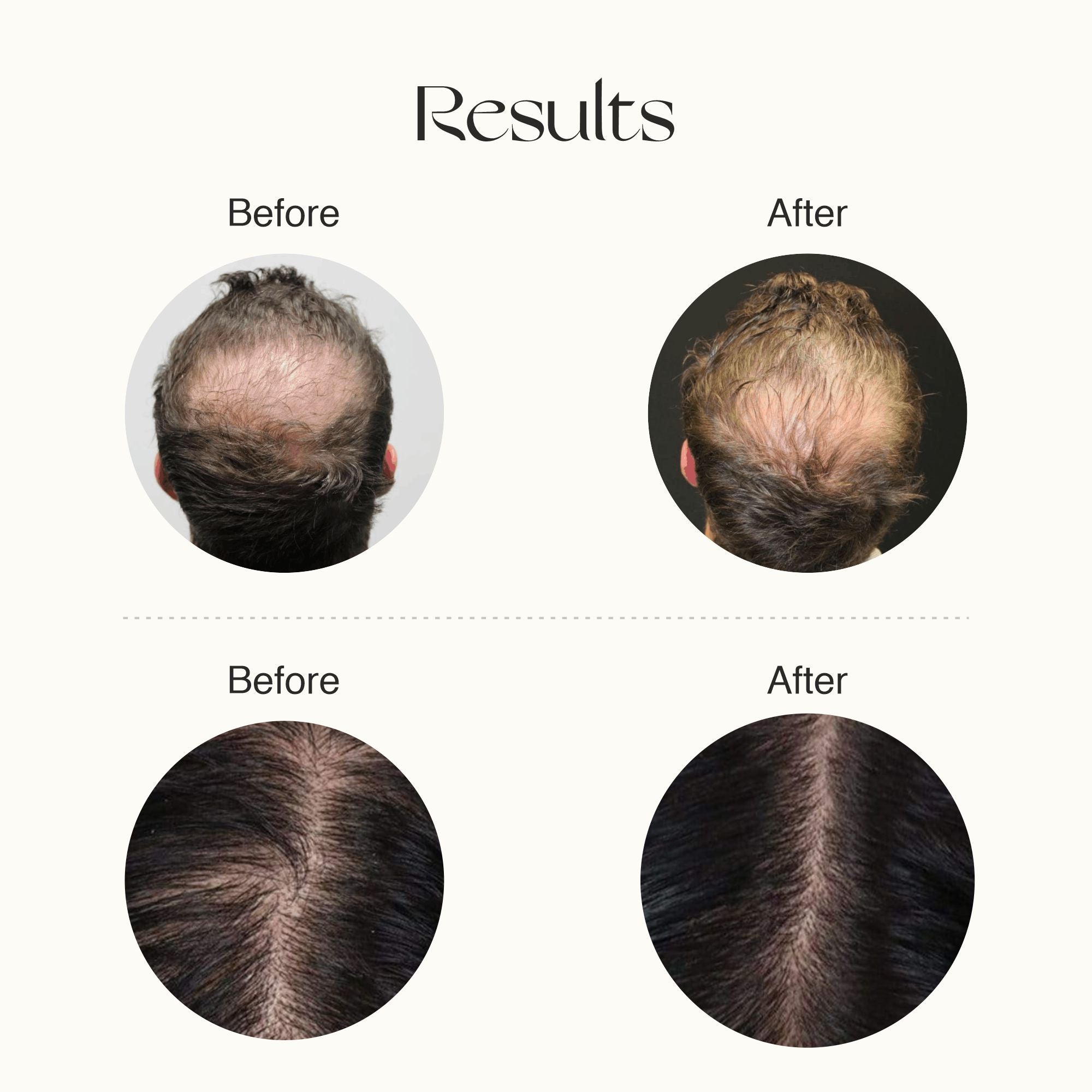 Nourish Mantra Advanced Hair Growth Serum - 50 ml (Pack of 2)