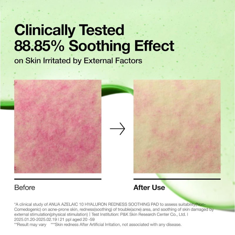 Anua Azelaic 10 + Hyaluron Redness Soothing Pad - 230 ml