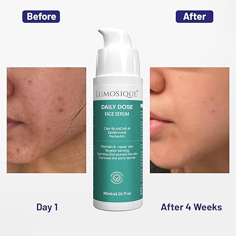 Lumosique Daily Dose Face Serum for Maintain & Repair Skin - 30 ml