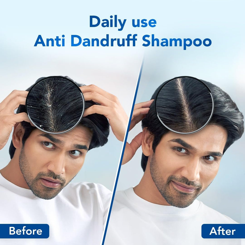 Scalpe Pro Daily Anti-Dandruff Shampoo | Removes Dandruff from Source | Helps with Itching, Irritation & Redness accompanying Dandruff | Scalpe Science | Climbazole & ZPTO Formulation | Strong & Smooth Hair | Daily Use | 100ml