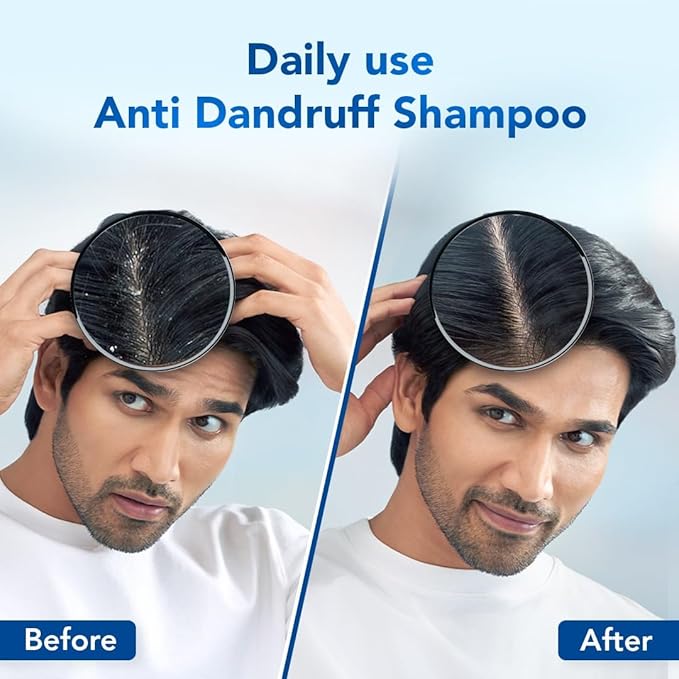 Scalpe Pro Daily Anti-Dandruff Shampoo - 100 ml