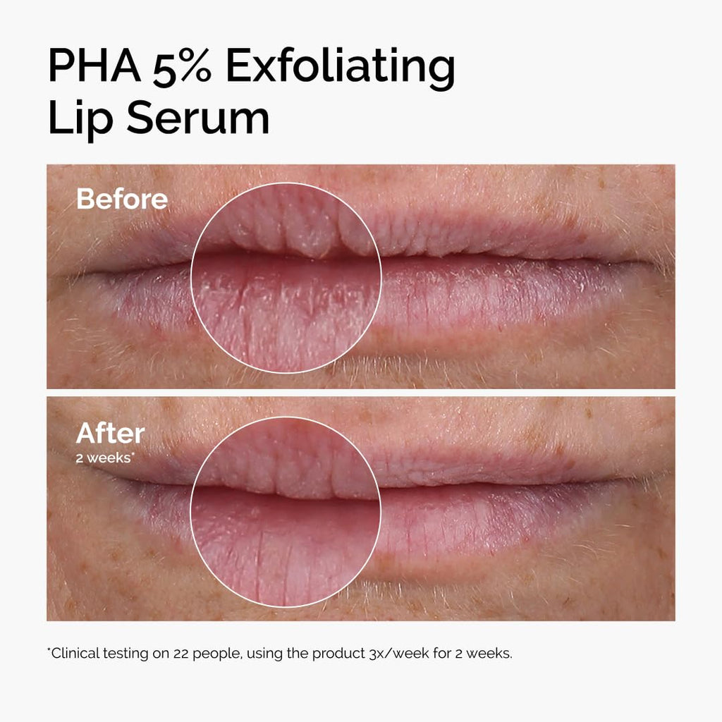 The Ordinary PHA 5% Exfoliating Lip Serum, Hydrating Overnight Lip Exfoliator Treatment, 15ml