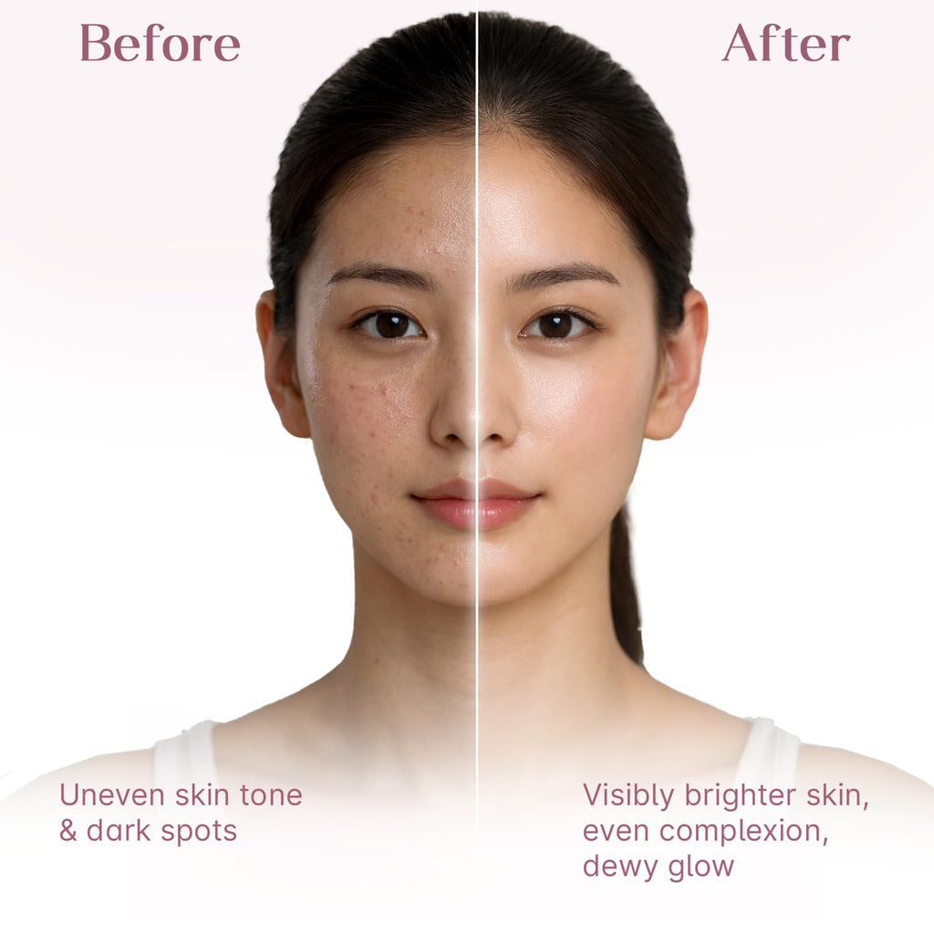 Seoulskin Kojic Acid Sunscreen SPF 50 PA ++++ | Helps Fade Dark Spots & Pigmentation | Non â€“ Sticky & Non- Greasy | No White Cast | Broad Spectrum UVA & UVB Protection | All Skin Types | For Men & Women | Lightweight Korean Sunscreen | 50 g