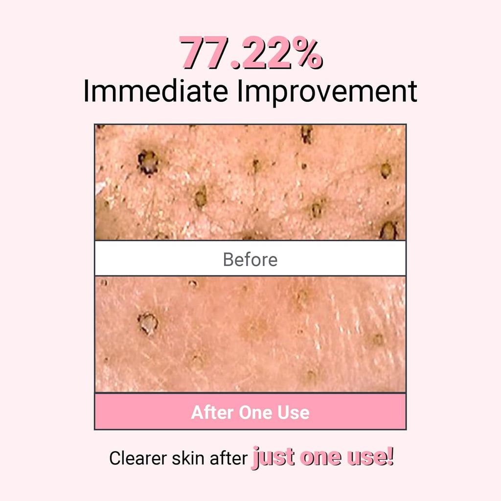 Kaolin Purifying Wash Off Pack, Pore Cleansing Mask for Dry Sensitive Skin, Softening amd Hydrating, Korean Skincare (3.88oz / 110g)