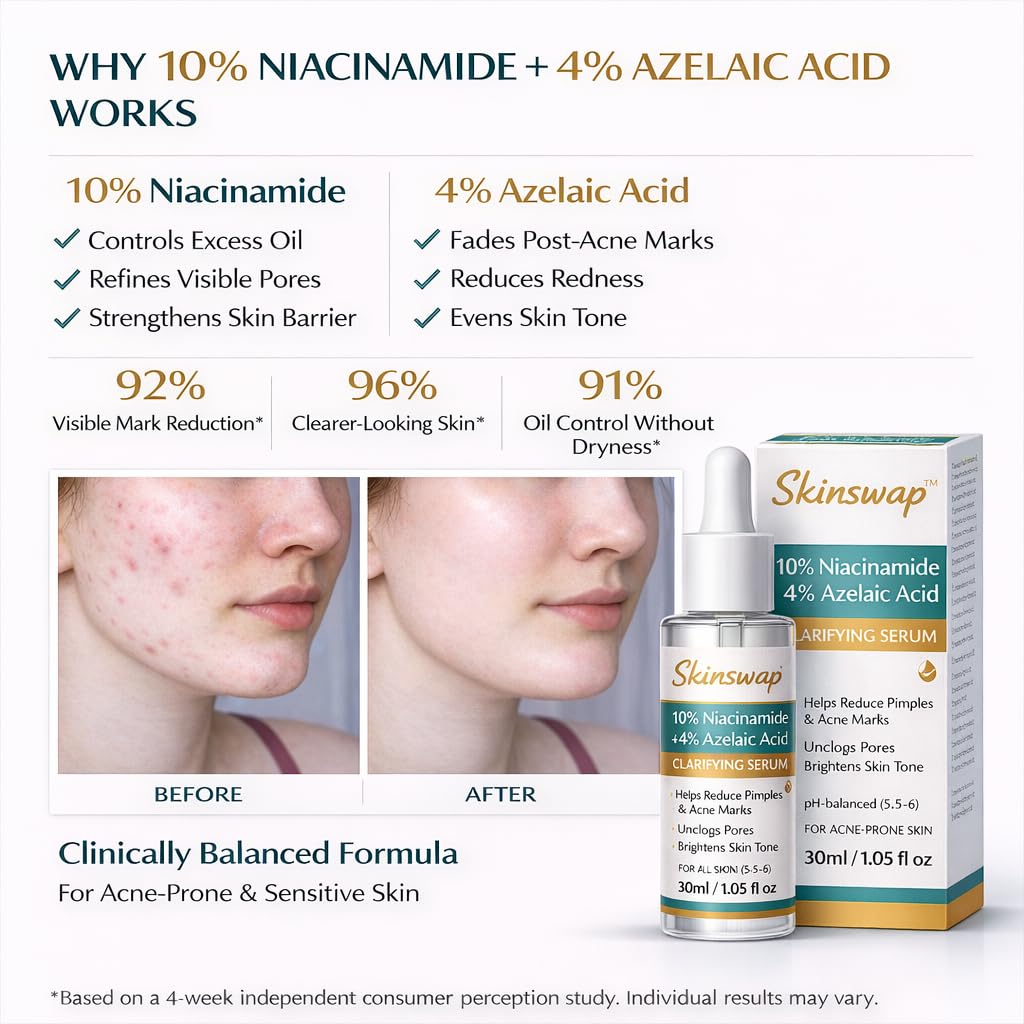 Skinswap Active 14% Niacinamide Serum with Azelaic Acid | Clarifying Face Serum for Brightening & Oil Control | Helps Reduce Acne, Blemishes & Acne Marks | Smooth, Clear-Looking Skin | For Women & Men | 30 ml