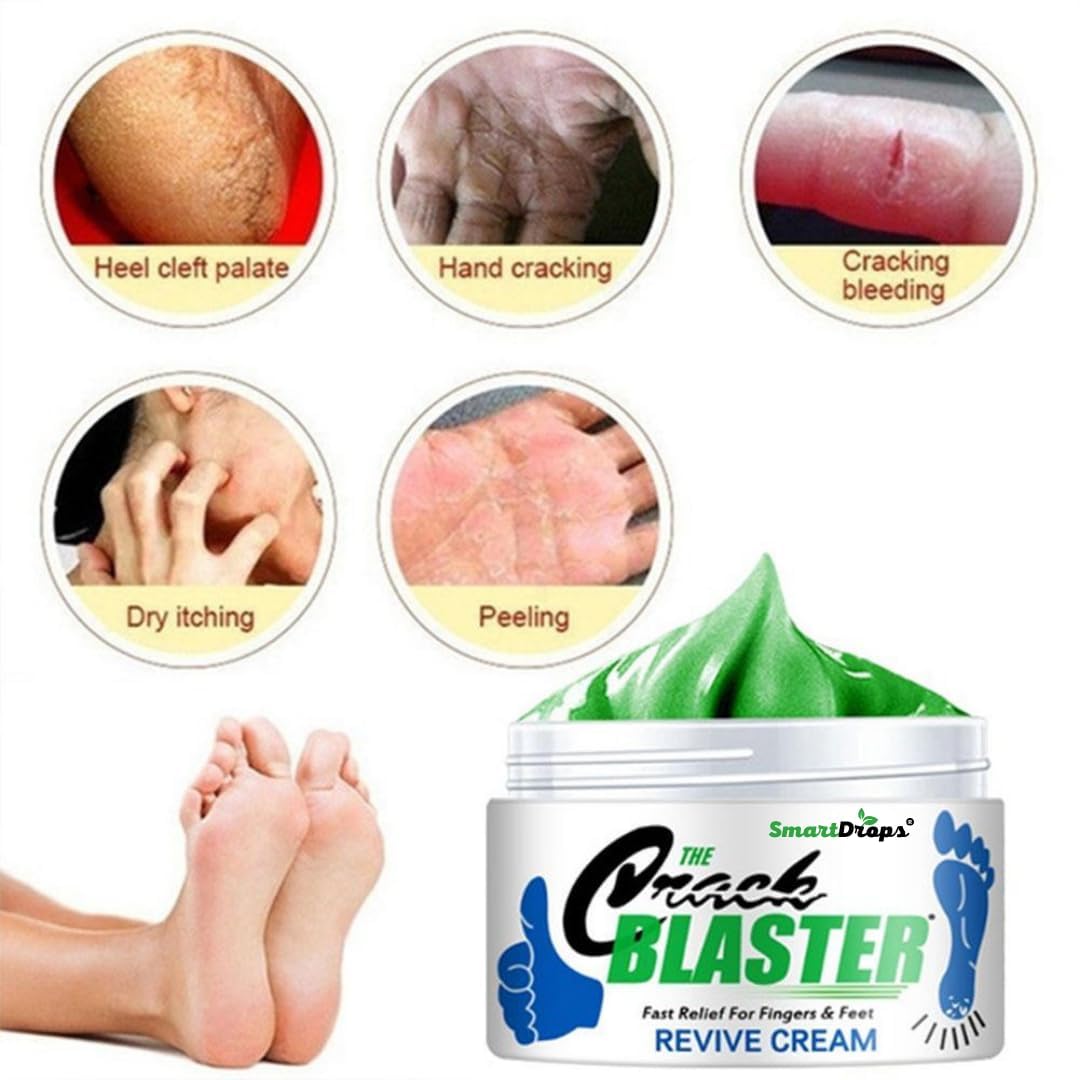 Smartdrops Foot Cream Deeply Moisturizes and Softens Feet & Elbow Skin - 50gm