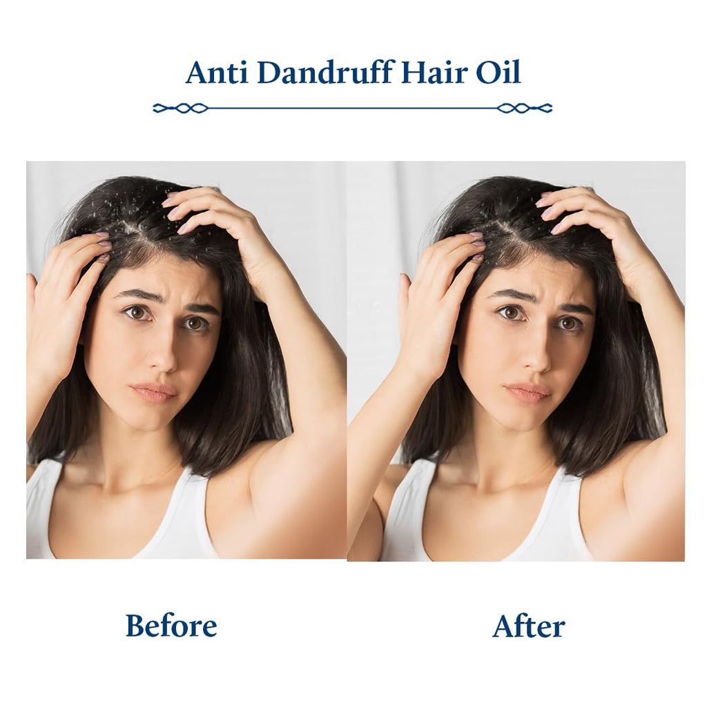 Blue Nectar Anti Dandruff Hair Oil | Ayurvedic Hair Oil with Neem, Tea Tree & Bhringraj for Hair Growth & Dandruff | Non-Sticky Hair Oil for Dry Scalp (12 Herbs, 100ml)