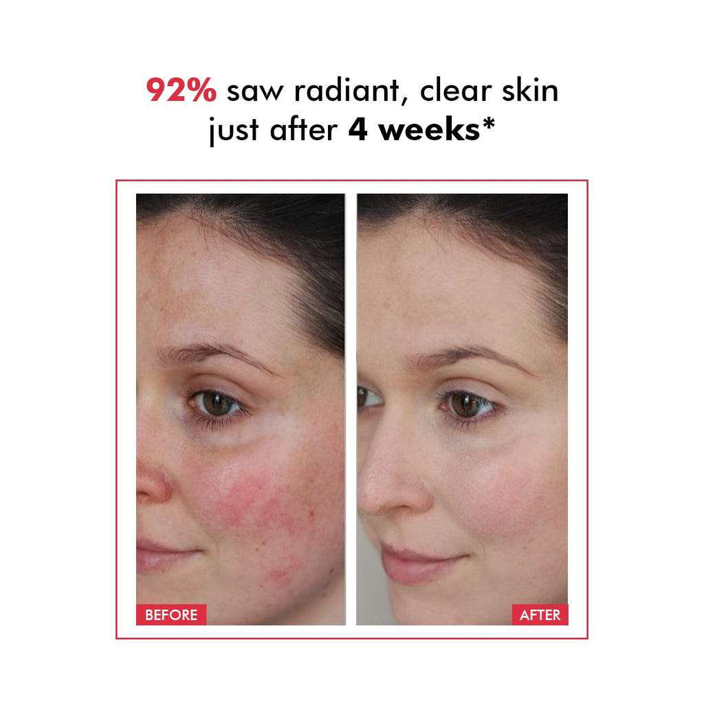 Conscious ChemistÂ® 25% AHA, 2% BHA, 5% PHA Peeling Solution | 30ml | Advanced Resurfacing AHA BHA Peeling Solution, Anti Aging Serum, Exfoliating Face Serum for Men & Women - Derm Date