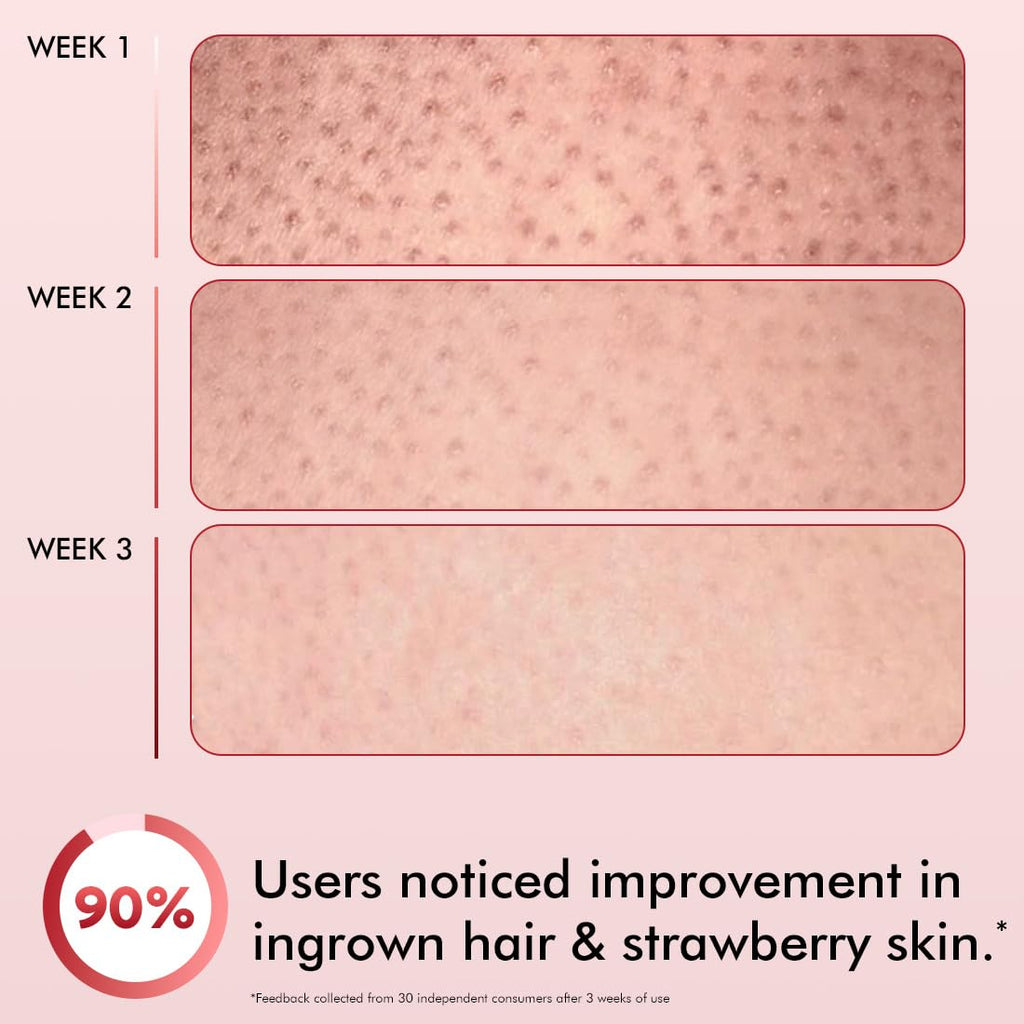 mCaffeine 11% AHA BHA Strawberry Body Lotion for Skin Smoothening | Gently Exfoliates Dead, Dry, Even Tones Skin | 72hr Moisturization | Juicy Strawberry Scent, For Men & Women-200ml