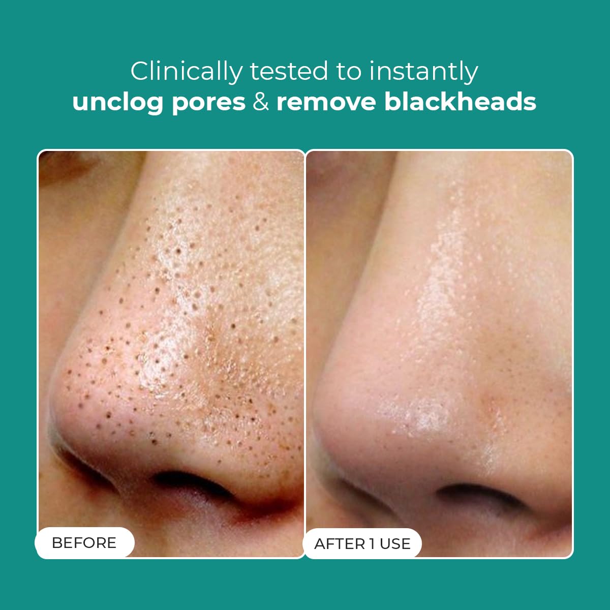 Conscious Chemist® Blackhead Melting Water | 130ml | Gentle Pore treatment with Succinic, Glycolic Acid & CICA Exosome | Unclogs Pores, Dissolves Blackheads & Smoothens Skin | Toner For Men & Women