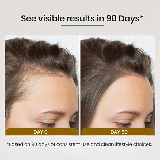 Lio Cosmeds Biofolli-S Anti Hair Fall Shampoo for Hair Growth - 100 ml