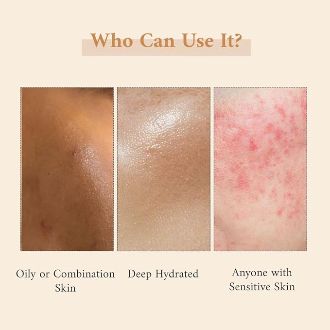 Zanya Hydrating Face Moisturizer With SPF 15 - 75 Gms
