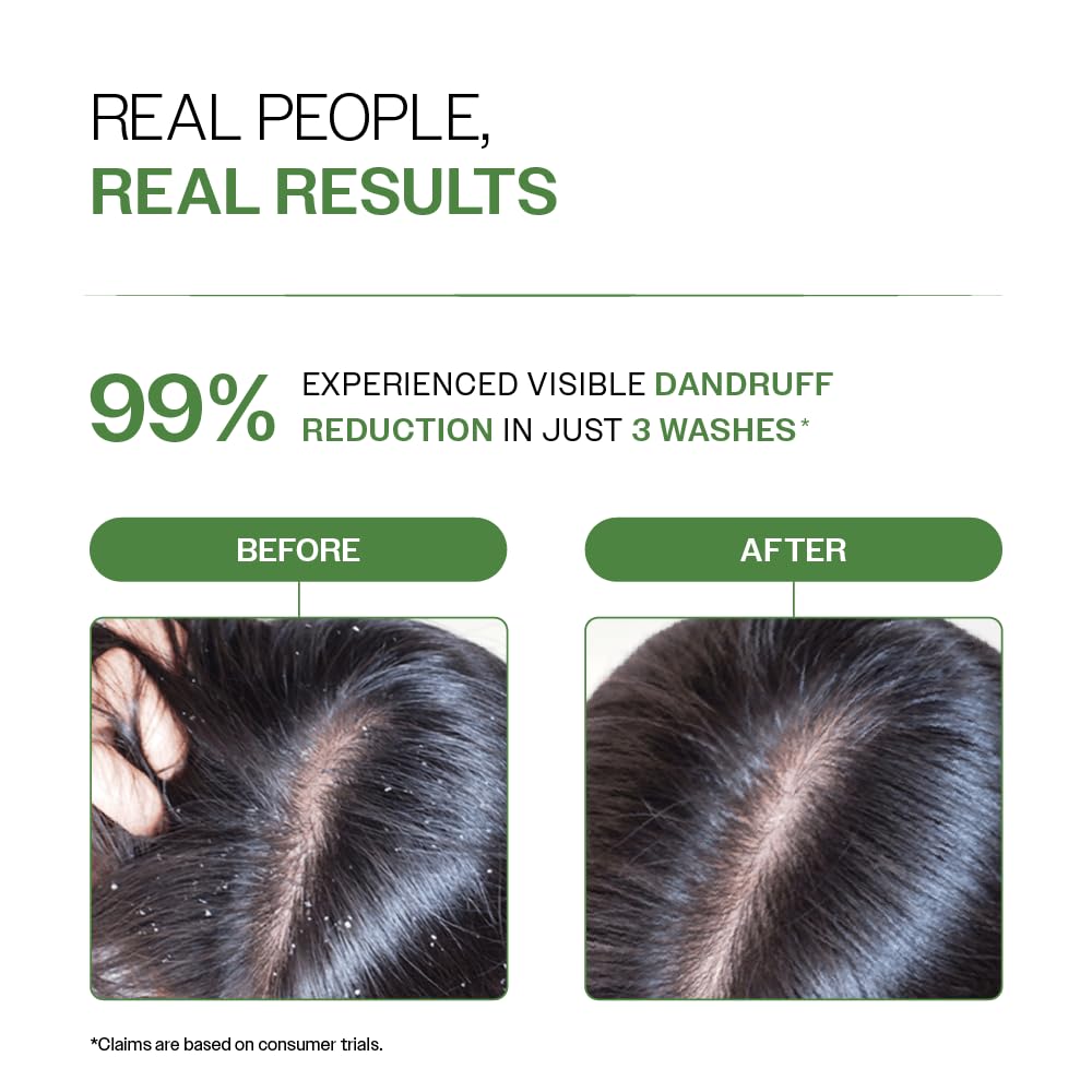 Bare Anatomy Anti Dandruff Shampoo | Reduces Up to 100% Dandruff and Strengthens Hair | Derma Approved Shampoo with Salicylic Acid & Biotin | Helps Remove Flakes and Itching | Shampoo For All Hair types | For Women And Men | 100ml