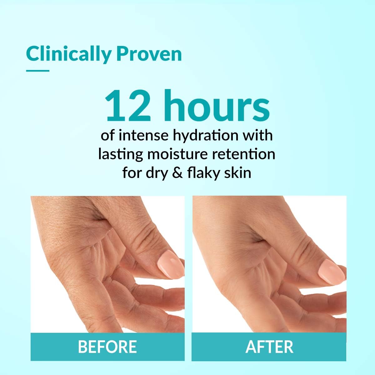 Fixderma Moisturizing cream, Daily Moisturizer for Dry & chapped skin, Provides Hydration and Moisturization, Non-Comedogenic & Non-Greasy formulation, 60g